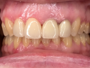 Real Results 10 10 2