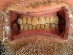 Real Results 27 IMG 4911